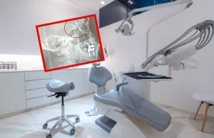 Chirurg w Turcji wbił implant dentystyczny aż do jamy mózgu pacjenta. Potem ucie