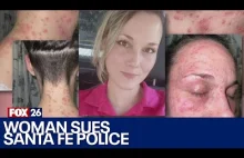 Kobieta pogryziona przez mrówki podczas zatrzymania pozywa policję do sądu