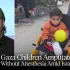 Dzieci w Strefie Gazy są poddawane amputacjom bez znieczulenia [ENG]