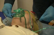 Elektrowstrząsy od lat budzą kontrowersje. Czy mogą leczyć depresję?