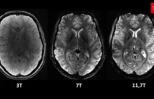 Bezprecedensowe obrazy ludzkiego mózgu uzyskane dzięki najpotężniejszemu MRI