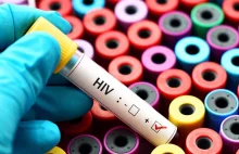 Anglia. Migracja spowodowała wzrost liczby przypadków HIV o 50% w ciągu roku