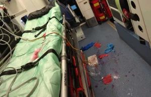 Pacjent zaatakował nożem policjanta. Konieczna była natychmiastowa operacja