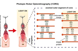 Przełomowa technika f-ORG w diagnostyce chorób siatkówki