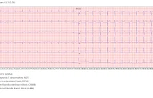 Stworzyłem darmowe narzędzie do nauki diagnozy EKG