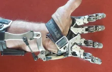 Niesamowita mechaniczna proteza palców wykonana we własnym warsztacie.