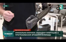 Proteza bioniczna: na Ukrainie przeprowadzono skomplikowaną operację