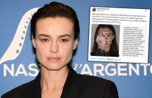 Najpierw Wiech, teraz Smutniak. Donos na polską aktorkę do... Mela Gibsona