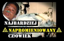 Hisashi Ouchi - Najbardziej napromieniowany człowiek w historii i jego męczarnia