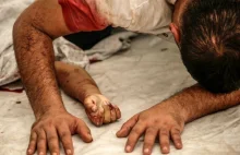 Bombardowania i głód. Horror cywilów w Strefie Gazy