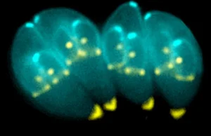 Toxoplazma: pasożyt, który przejmuje nasze mózgi