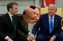 Co się stało? Tajemniczy siniak na dłoni Trumpa