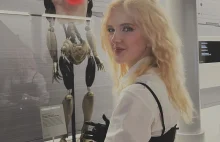 Poznaj Tilly Lockey: angielską nastolatkę z protezami bionicznymi