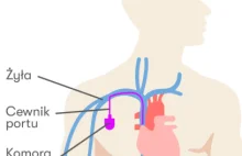 Pokój pielęgniarek, dzień dobry, mój krewniak ma port naczyniowy, ciąg dalszy