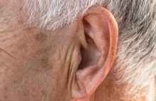 Znak Franka na uchu - Powiązanie zmarszczki na płatku ucha z chorobami serca