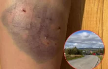 2 psy zaatakowały i pogryzły biegaczkę w Nowym Targu