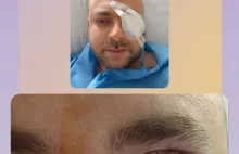 Na dalsze leczenie ratowania wzroku oraz zakup tanometru. Wspieraj na Zrzutka.pl