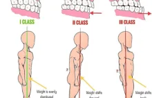 Kiedy zęby nie pozwalają chodzić?!