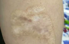 Białoruskiego więźnia zmuszono do własnoręcznego usunięcia tatuażu z Pogonią