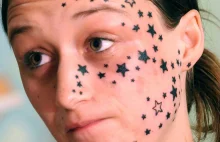 Belgijka usunęła 56 gwiazdek wytatuowanych na twarzy za 13 tys. dolarów