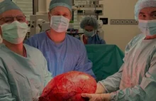 Gdańsk.Lekarze usunęli 14-kilogramowego raka nerki. Wypełniał całą jamę brzuszną
