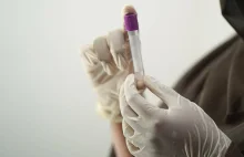 Groźny wirus z Chin dotarł do Europy.