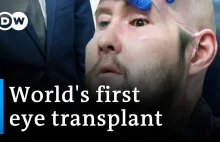 Pierwszy na świecie przeszczep oka powiódł się