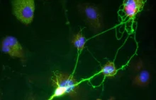 Odkryto nowy rodzaj komórek w mózgu - komórki hydrydowe