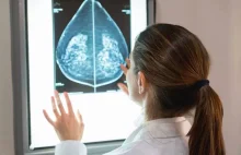 Sztuczna Inteligencja potrafi wykryć raka piersi