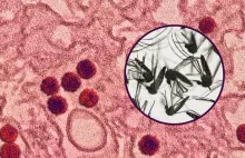 Wirus Zika: Przełom w sprawie szczepionki. Sukces polskich naukowców