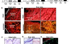 Skład i budowa blizn skóry różnią się w zależności od płci