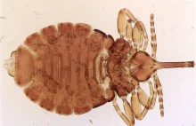 Wszy, czyli niechciany spadek po dinozaurach