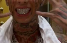 Johnny Dang na Instagramie : "FLAWLESS TWIN GRILLZ for the #IslandBoys Its a Dub