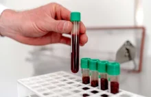 Holandia: u prawie wszystkich ilość PFAS przekracza zalecane normy