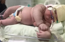 Olbrzymie niemowlę zszokowało matkę i lekarzy!