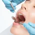 Koniec z implantami, plombami i leczeniem kanałowym. Rewolucja w leczeniu zębów