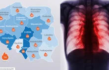 Lekarka nie ma wątpliwości: Zdrowie Polaków zagrożone. Mapa pokazuje skalę