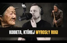 Miała 101 lat i rogi! - Niezwykły przypadek Zhang Ruifan