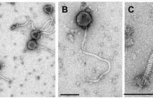 Co zawdzięczamy wirusom: bakteriofagi, czyli wielopoziomowa gra strategiczna