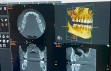 Jak wyleczyć i wzmocnić zęby, aby nie potrzebować dentysty wg dentystki dr Ellie