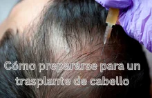 Cómo prepararse para un trasplante de cabello