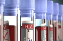 Nowy sposób na leczenie HIV. Sukces czy niekoniecznie? Nauka To Lubię