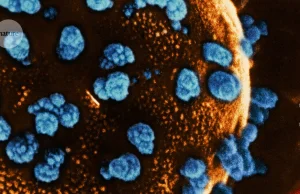 Nature: Dzięki komórkom macierzystym wyleczono cukrzycę typu 1 oraz typu 2