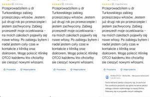 Klinika przeszczepu włosów od Gimpera kupiła pozytywne opinie Google?