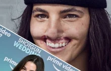 Zaatakował ją pies. "Nie zdawałam sobie sprawy, że odgryzł mi całą wargę"