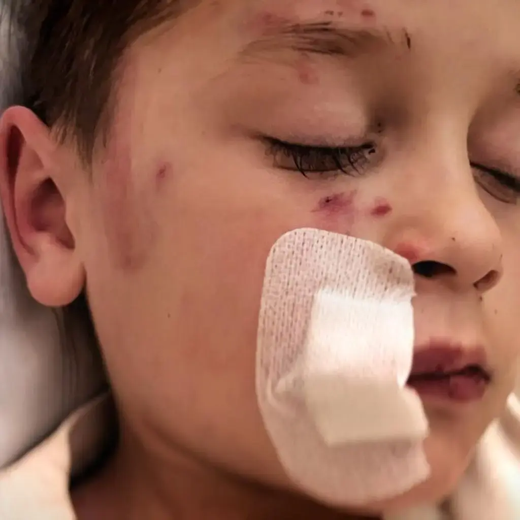 Pogryzieni. Życie z traumą