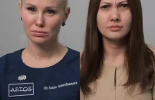 Porównanie mimiki twarzy z botoksem i bez botoksu.