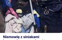 Niemowlę z siniakami trafiło do szpitala