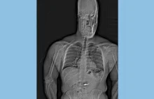 Połknął kolczyki warte 769,500 tys $.