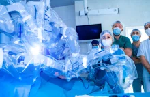 Chiński robot wkracza do Polski. Nowe informacje o eksperymencie medycznym